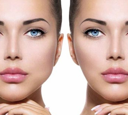 bichectomia md Odontología